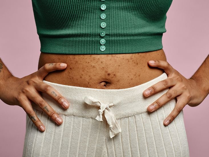 GRT female stomach 732x549 thumb.jpg